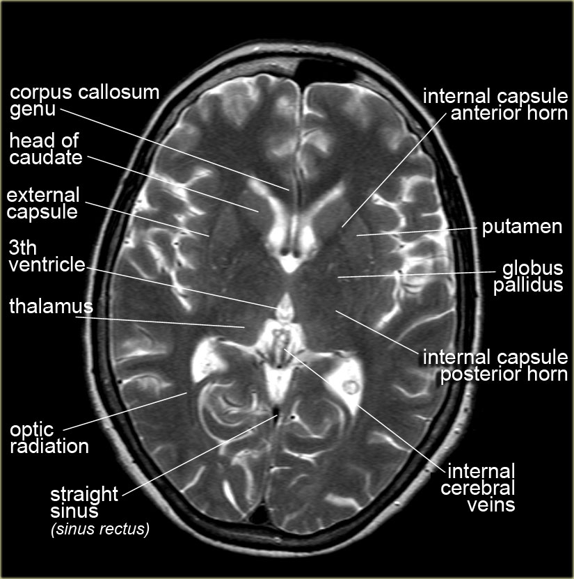 Stroke Medicine For Stroke Physicians And Neurologists