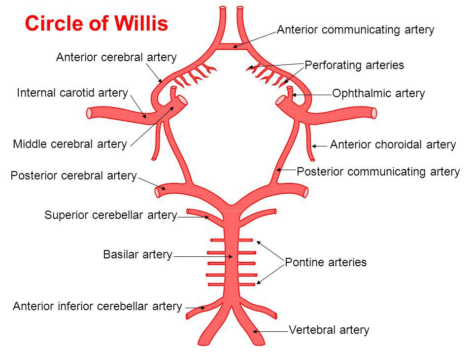 Posterior Choroidal Artery Stroke